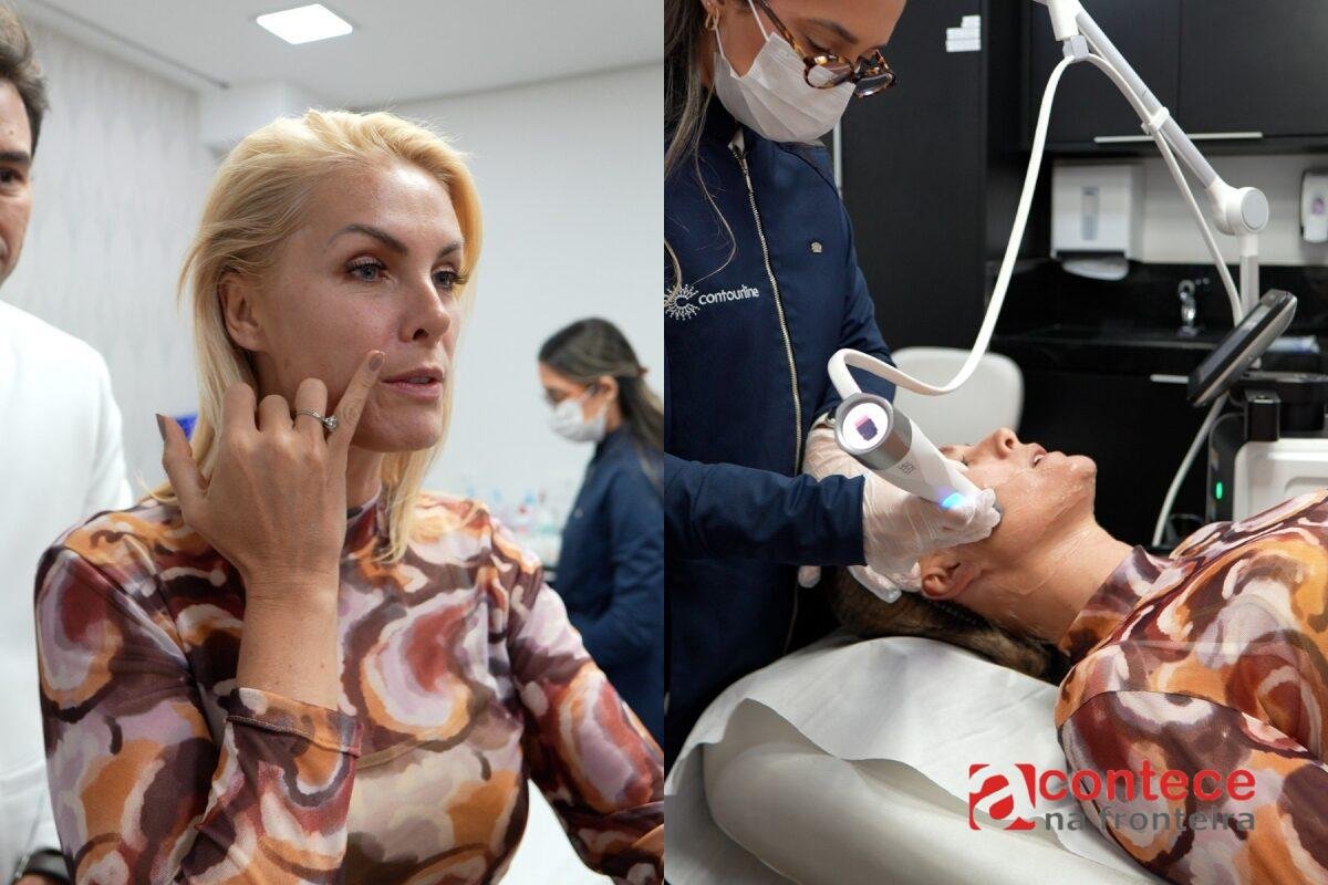 Ana Hickmann faz procedimento estético antes de casamento com Edu Guedes