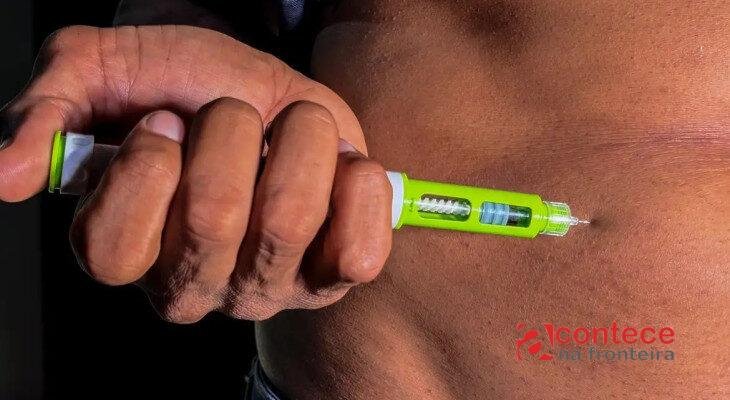 SUS no Paraná pode receber canetas emagrecedoras para obesidade