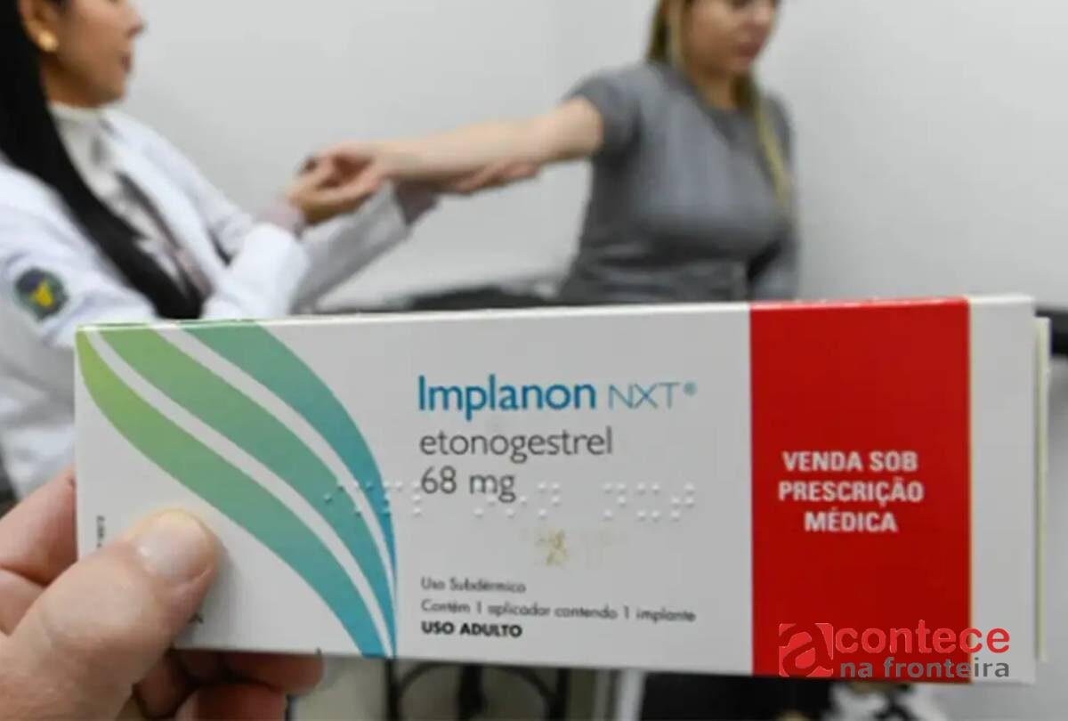 Anvisa amplia validade do implante contraceptivo Implanon