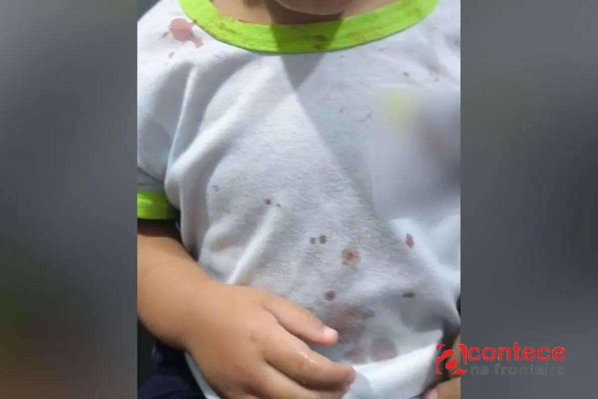 Criança chega à CMEI com ferimentos e camisa com manchas de sangue, e polícia prende padrasto por maus-tratos