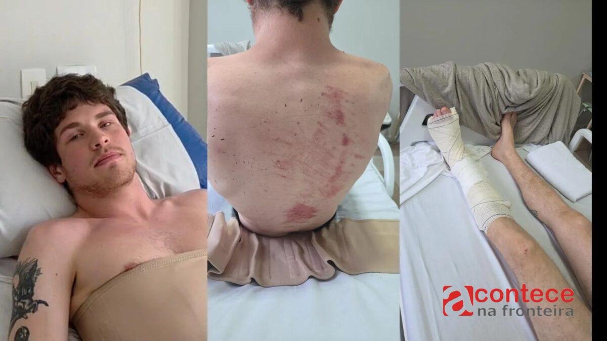 'É um alívio não estar no hospital, mas me sinto angustiado', diz jovem atingido por galho na Praça Osório em Curitiba
