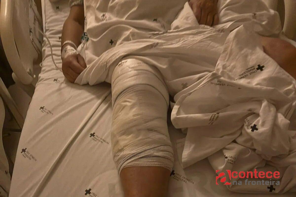 Idosa de 72 anos passa por cirurgia e tem joelho errado operado